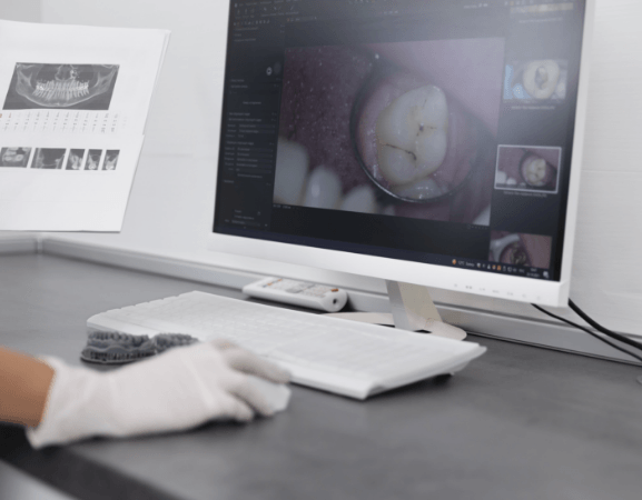 Cavity Detection System