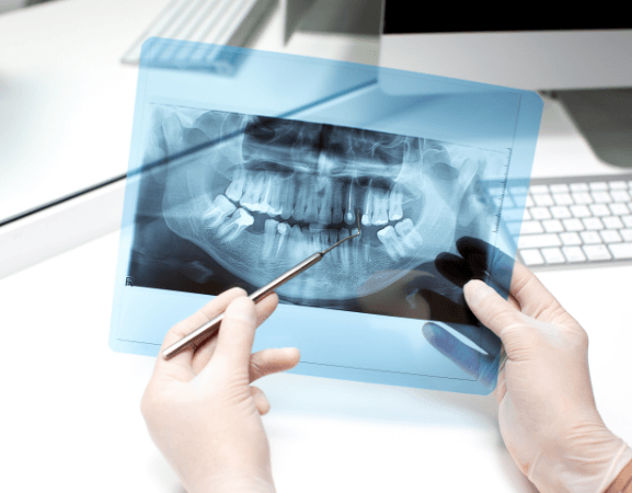 Panoramic X-Ray For Oral Health Examination