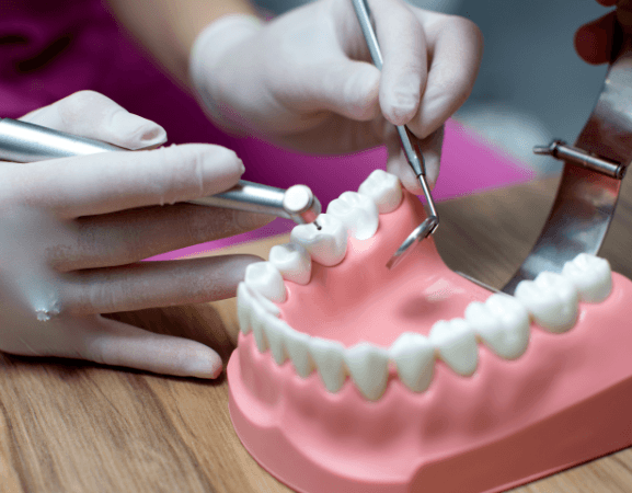 Full Mouth Reconstruction