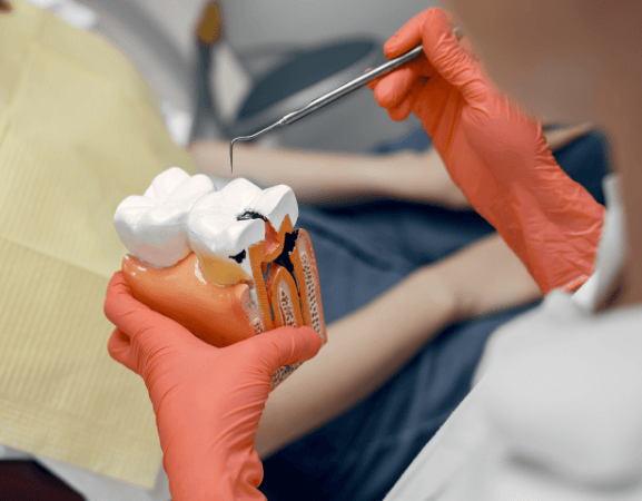 A root canal treatment.