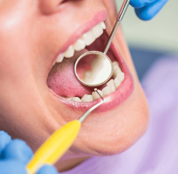 Dental Checkup With Mirror And Dental Tools